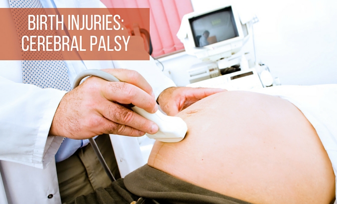 Birth Injuries - Cerebral Palsy Misdiagnosis