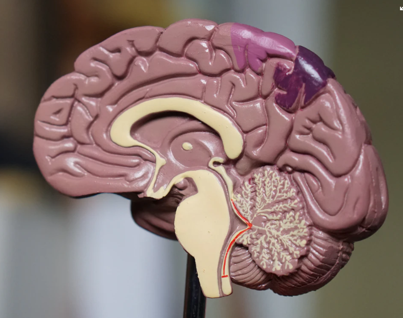 brain injury