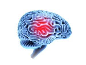 brain injury lawyer west palm beach